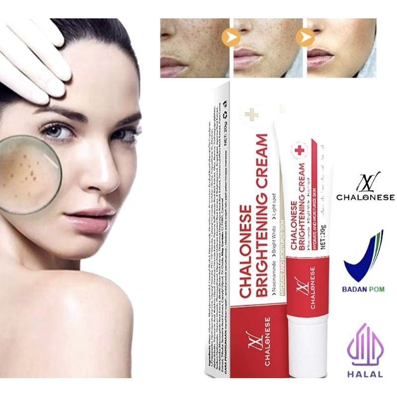 Chalonese Brightening Cream – Buy 1 Get 1 Free