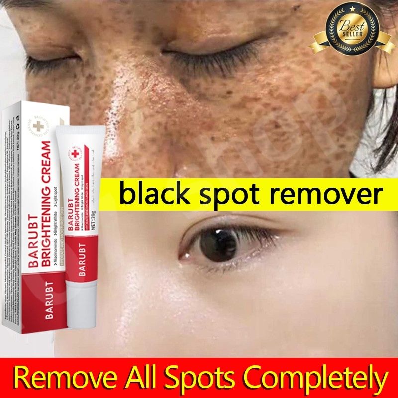 Chalonese Brightening Cream – Buy 1 Get 1 Free