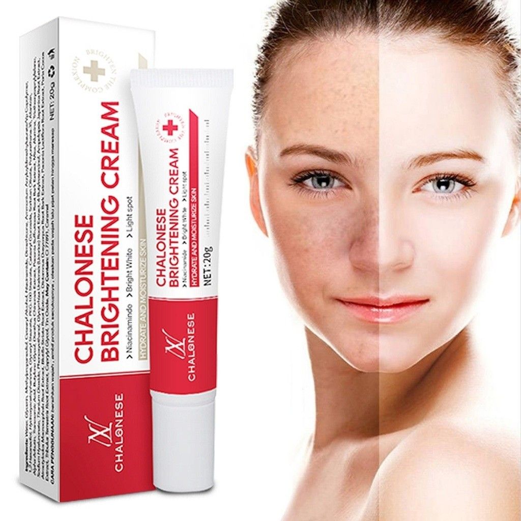 Chalonese Brightening Cream