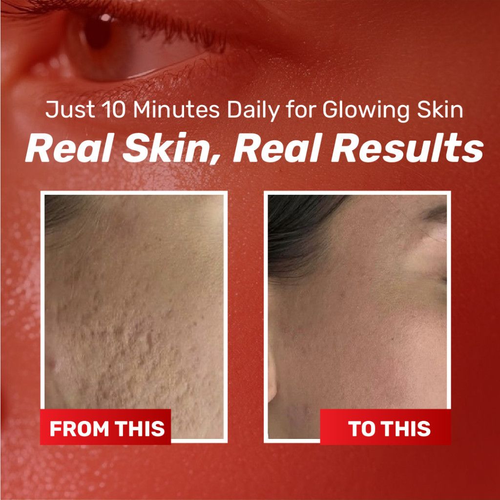 Chalonese Brightening Cream