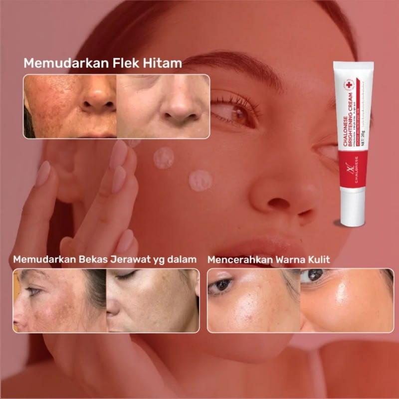 Chalonese Brightening Cream