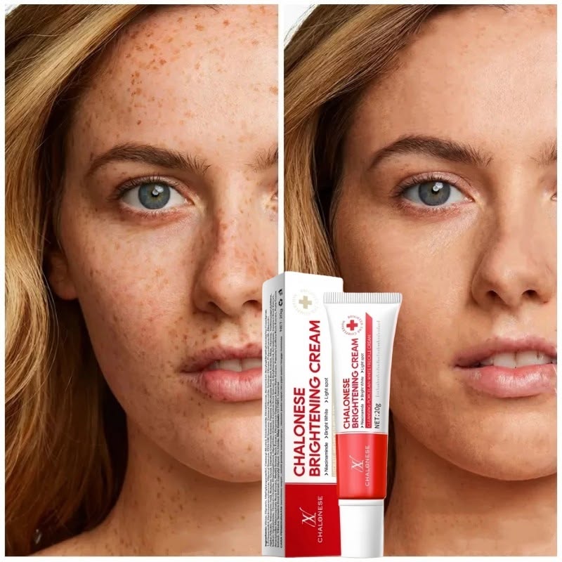 Chalonese Brightening Cream – Buy 1 Get 1 Free